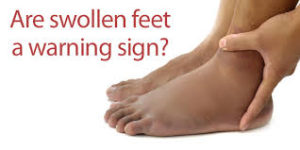 Dealing with Diabetes and Swelling of Feet - Almawi Limited The