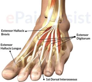 What Is Extensor Tendonitis Almawi Limited The Holistic Clinic