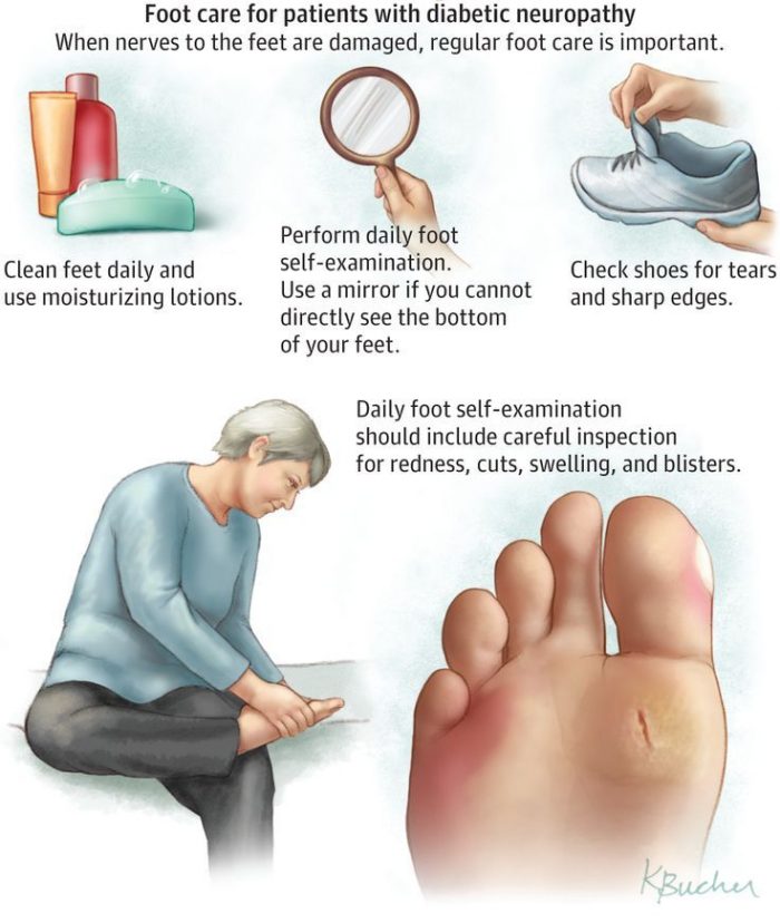 Foot Care For Diabetic Patients Almawi Limited The Holistic Clinic