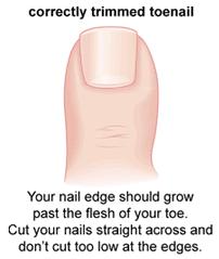 how-to-cut-your-toenail - Almawi Limited The Holistic Clinic