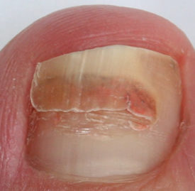 What's Going on with My Toenail? - Almawi Limited The Holistic Clinic