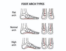 Foot Arch Type Chart