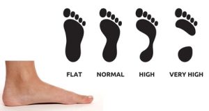 What’s Up With My Arches? - Almawi Limited The Holistic Clinic