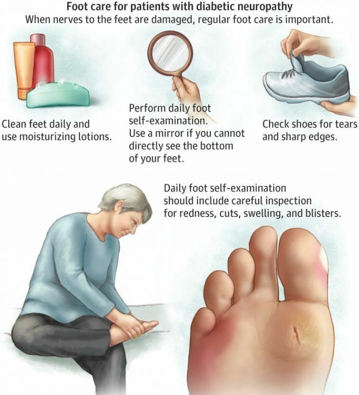 Diabetic Neuropathy and Your Feet - Almawi Limited The Holistic Clinic