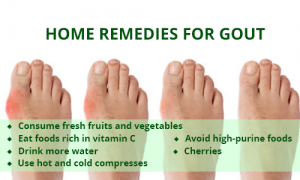 Gouty toe after the holidays - Almawi Limited The Holistic Clinic